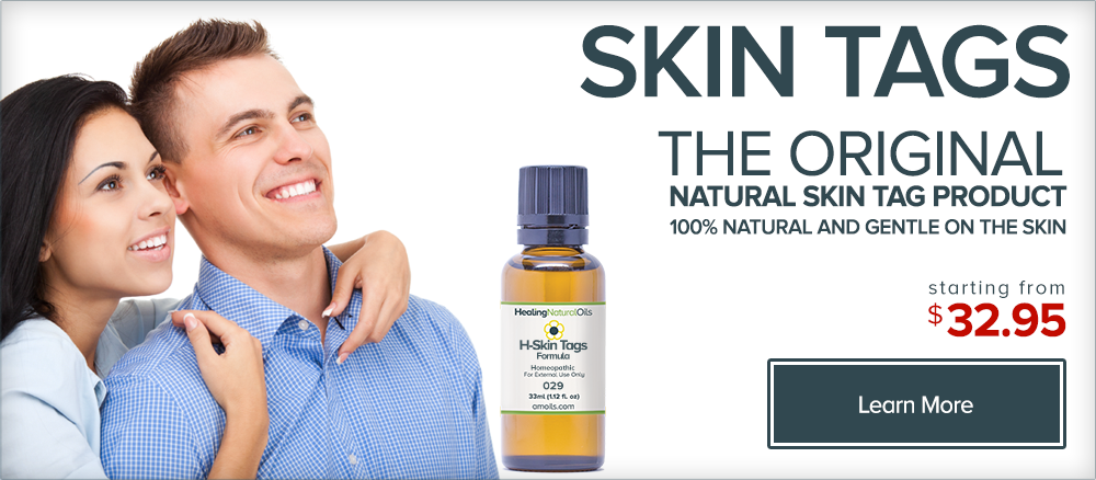 skin tag removal cream