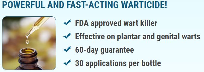 wart removal cream