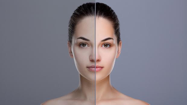 skin whitening cream
