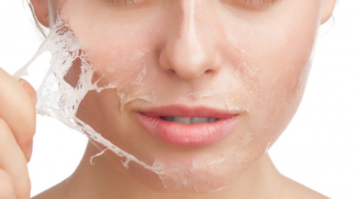 skin lightening peels