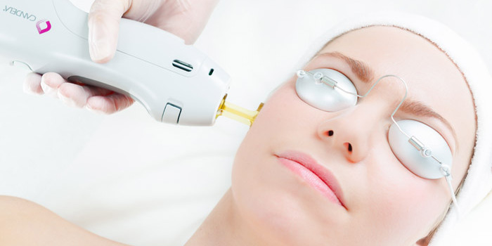 skin lightening treatment