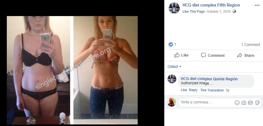 hcg complex